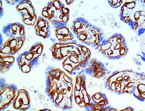 IHC of Caveolin 1 on a FFPE Placenta Tissue